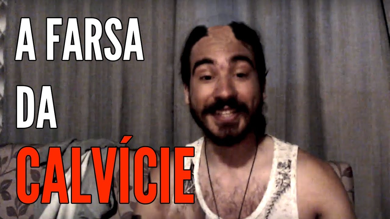 Porque Calvície NÃO É GENÉTICA (e como curar/evitá-la)