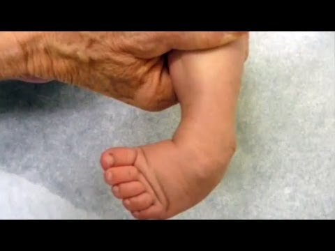 download lagu mp3 mp4 Club Foot, download lagu Club Foot gratis, unduh video klip Club Foot