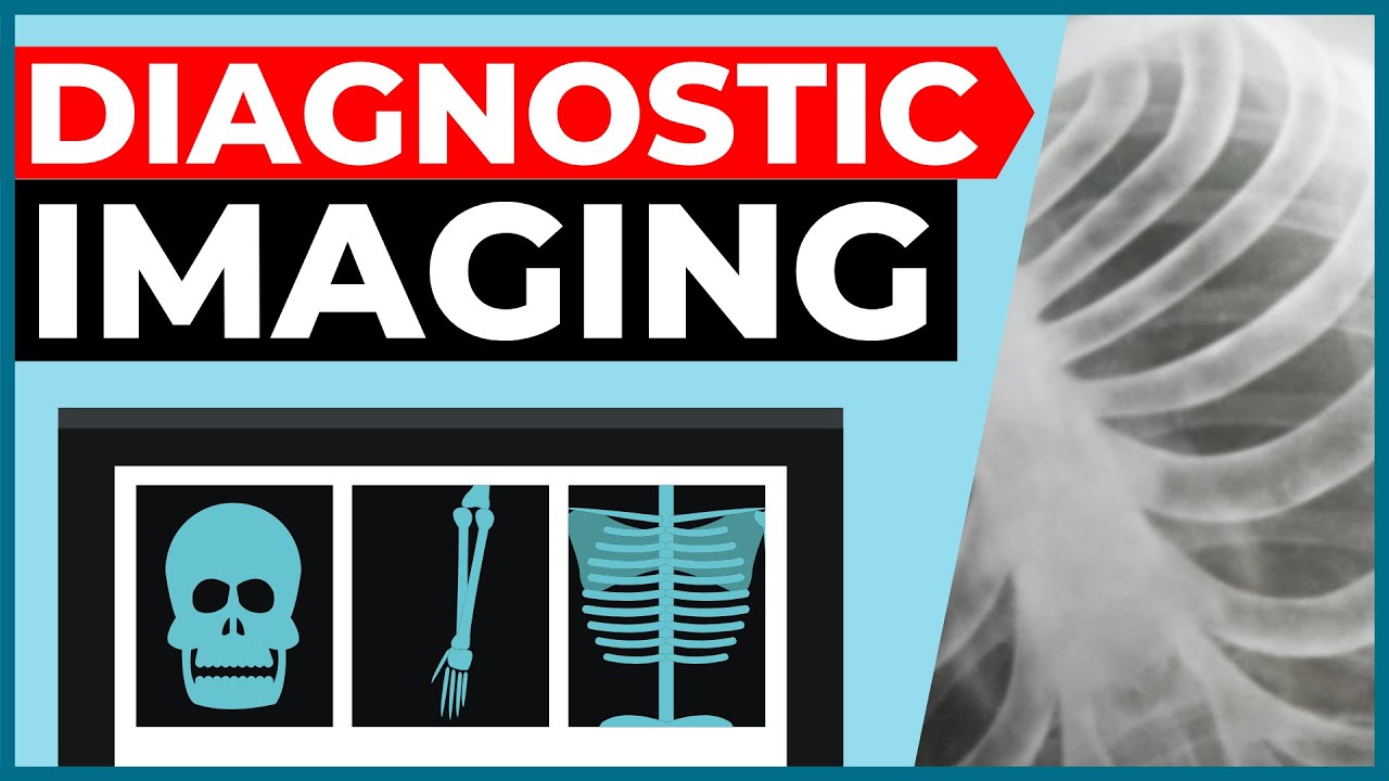 Diagnostic Imaging Explained (X-Ray / CT Scan / Ultrasound / MRI)