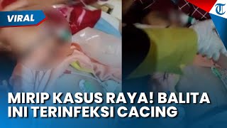 Mirip Kasus Raya! Balita Cacingan di Bengkulu, Cacing Menggumpal di Perut Akibat Hidup Tak Sehat