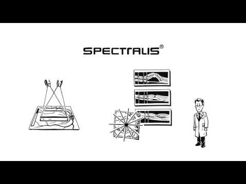 🇩🇪 SPECTRALIS OCT