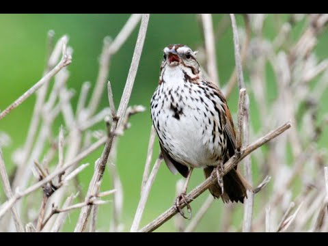 Hearing Loss - before the implant