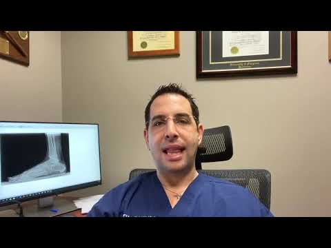 The Best Treatment for Toenail Fungus, According to a Podiatrist