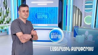 Եղիր առողջ. լազերային քարափշրում