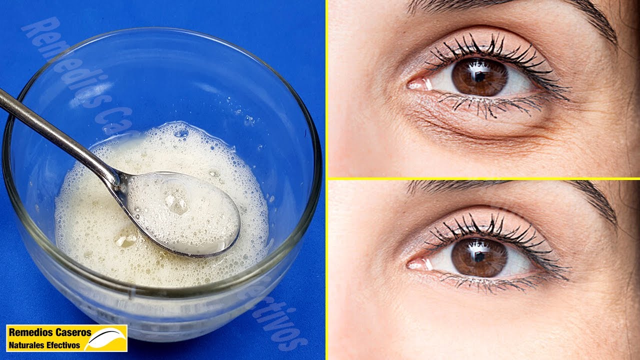 Sólo Usa Esto 3 Veces A La Semana - Eliminar Arrugas Y Ojeras Debajo De Los Ojos Rápidamente