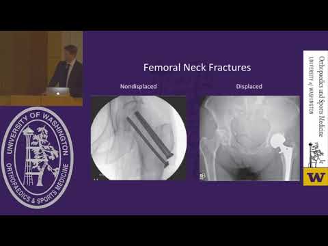 Geriatric Hip Fractures- Avoiding Pitfalls When Taking Call