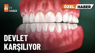 ÖZEL HABER – Çene botoksuna devlet desteği - atv Ana Haber 21 Nisan 2025