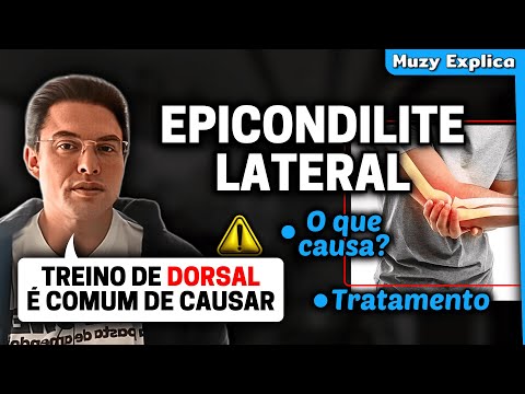 EPICONDILITE LATERAL DO COTOVELO | Muzy Explica