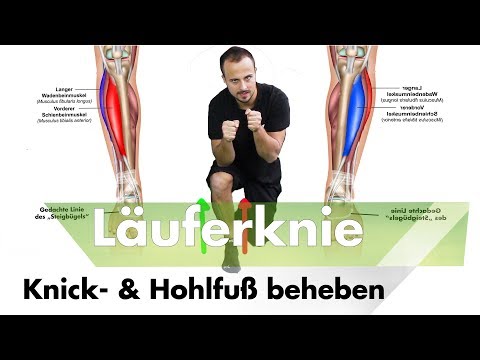 Läuferknie wegen Knick- & Hohlfuß ? | Übungen gegen Runners Knee