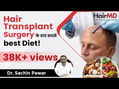 Best Diet After Hair Transplant Surgery | Which Food...