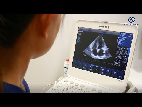 Transthoracic Echocardiography - What does it check for?