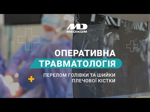 Металлоостеосинтез - видео