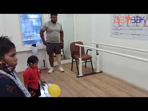 Above Knee Prosthetic Leg
