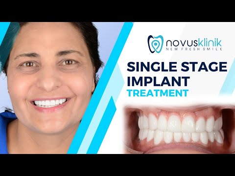 Logo of 72-Hour Restorations at Novusklinik – Affordable Dental Implants in Istanbul, Turkey