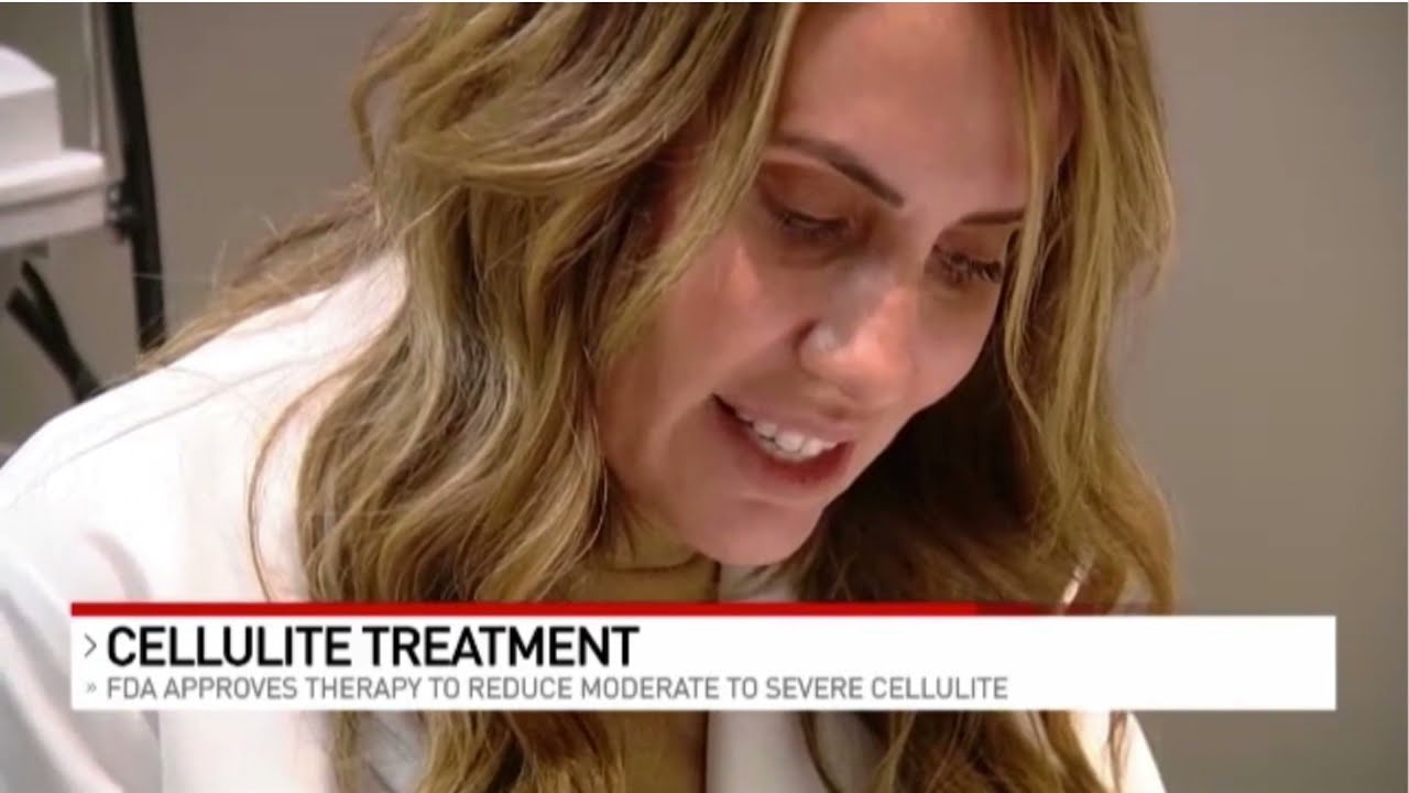 FDA approves new treatment to reduce moderate to severe cellulite!  Meet the Exclusive providers...