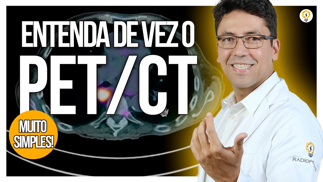 O que é o PET/CT e como é REALIZADO O EXAME