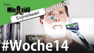 Das Minoxidil Experiment #Woche14 Harter Bartverlust + News