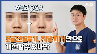 복코 코끝연골묶기만으로 복코, 슬림하게 개선 가능한가요? 콧볼축소는? 코끝지방제거 효과 궁금해요.