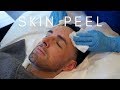Obagi Blue Peel Radiance | The Laser and Skin Clinic