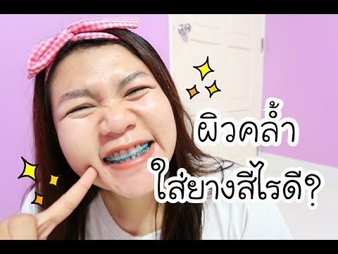 เป็นเทคนิคโบราณของการเพิ่มสมาชิก Impaza ใช้ความคิดเห็น