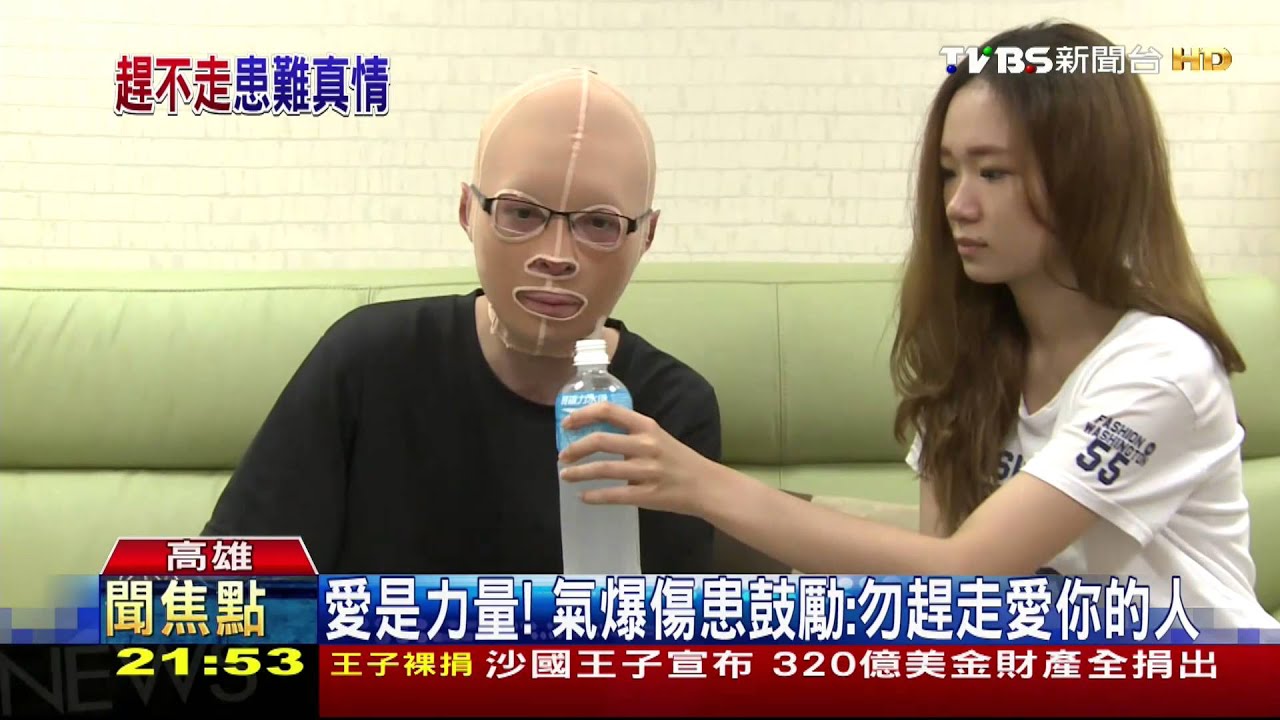愛是力量! 氣爆傷患鼓勵:勿趕走愛你的人