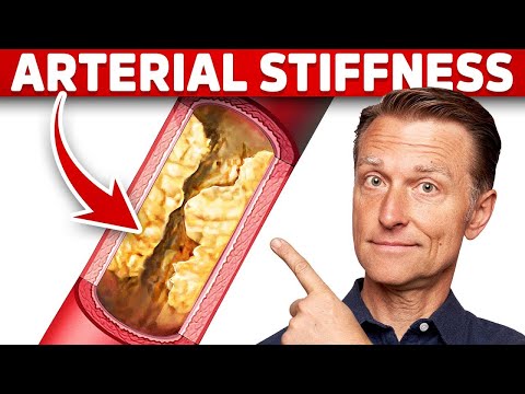 If You HAD to Pick One Stroke or Heart Attack