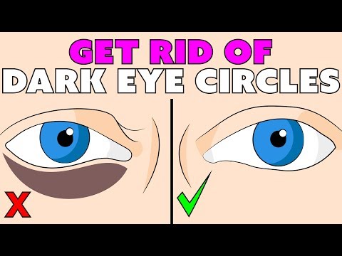 How to get rid of the dark circles under your eyes naturally - do it 2 times a day