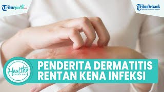 Waspadai Penderita Penyakit Kulit Dermatitis Rentan Terkena Infeksi, Begini Kata Dokter