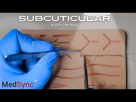 Subcuticular Sutures: The intradermal Stitch Patients Love - This Is Why