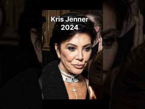 2024 Kris vs 2025 Kris… Is this even the same person?! 🤯. #kardashians #krisjenner #kimkardashian