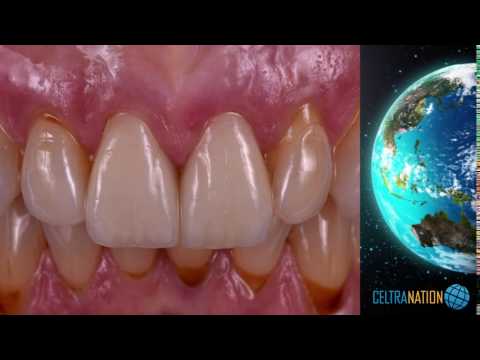 CELTRANATION is born !