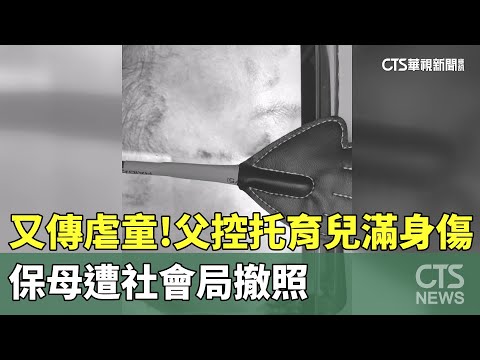 又傳虐童！　父控托育兒滿身傷　保母遭社會局撤照