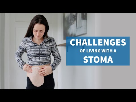 Overcoming the Challenges of Living with a Stoma