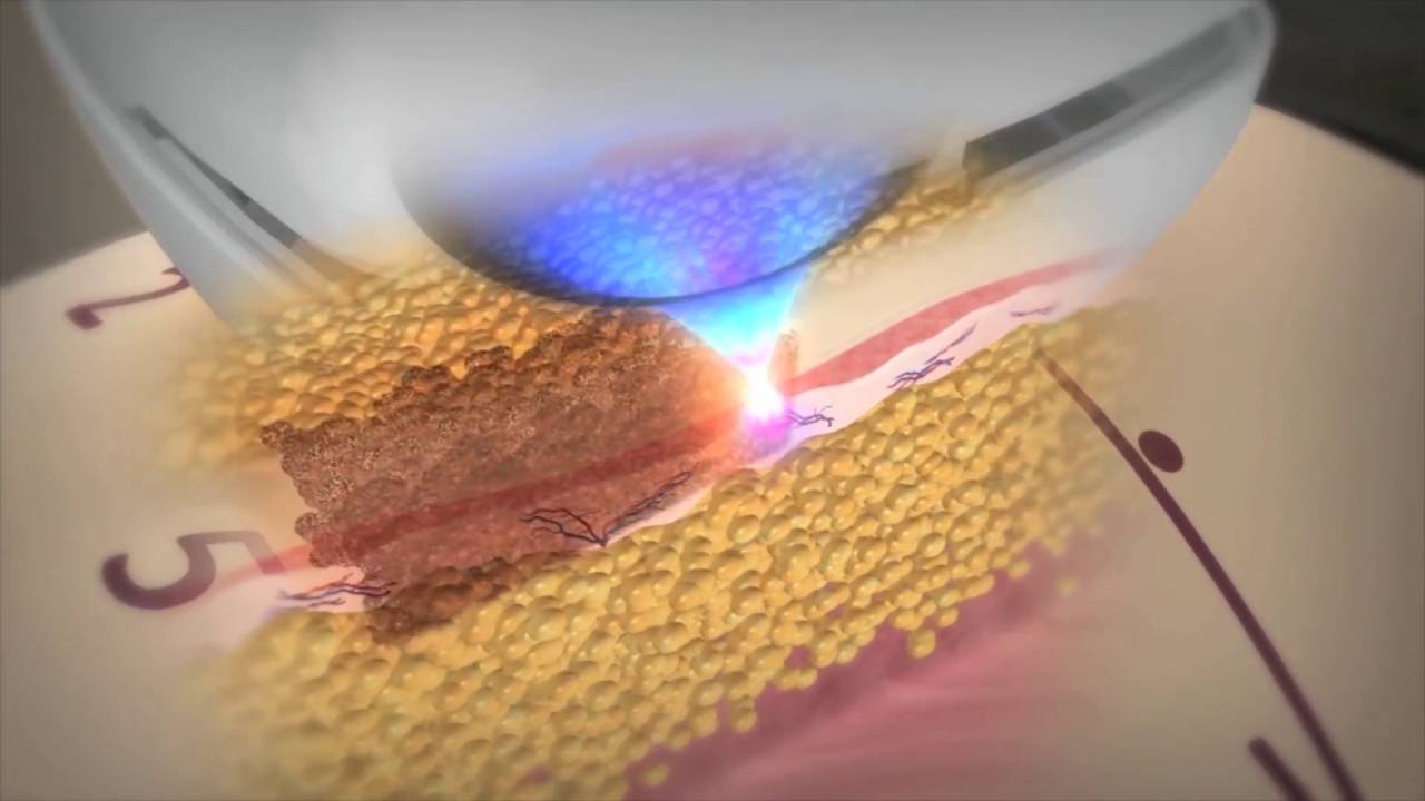 Claudine Guasco Herrera-9