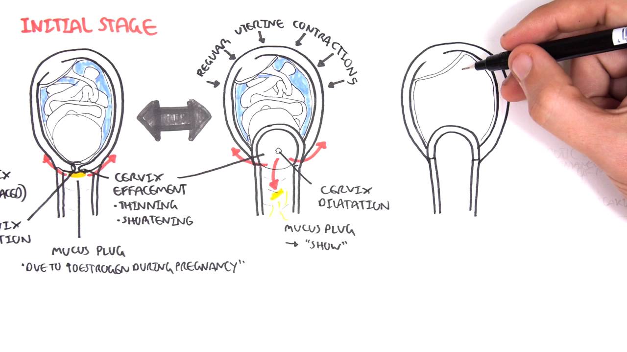 Obstetrics - Stage I of Labour