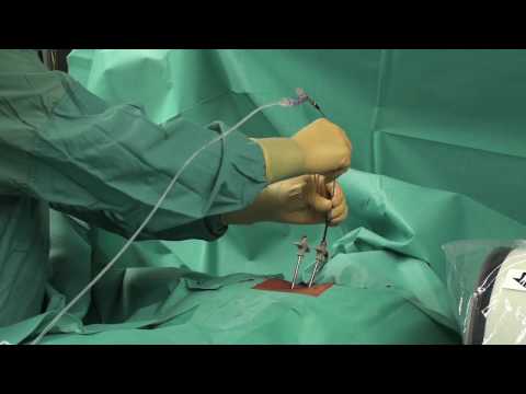 Speiseröhre und Nackenschmerzen Gelenkschmerzen als Schmerzen lindern