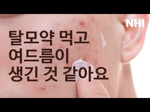 탈모약 먹고 여드름이 생긴 것 같아요ㅣ뉴헤어