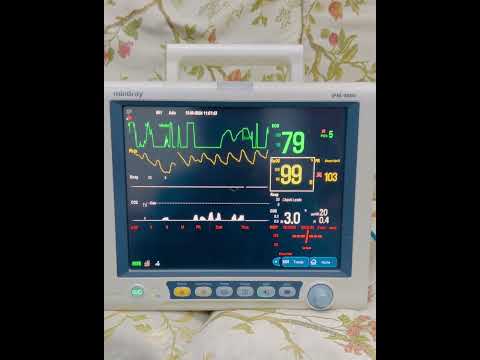 Mindray IPM9800 Cardiac Monitor 7 parameters with Co2 #mindray