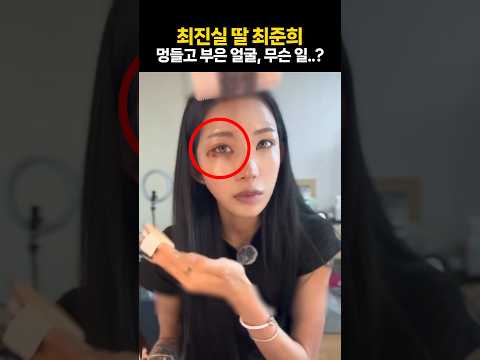 최진실 딸 최준희의 멍들고 부은 얼굴, 무슨 일이길래..?