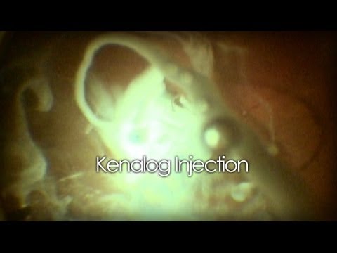 Ciò che lanalisi con osteoartrosi del ginocchio Dolore forte crescita nel collo