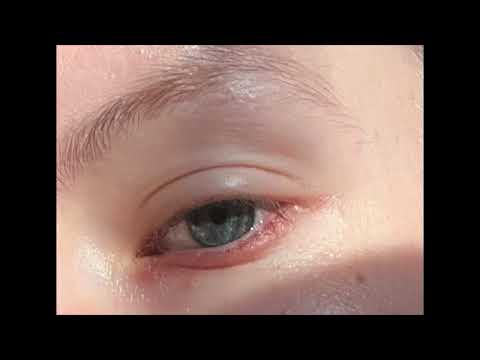 Rosa Anschütz - Double Cross