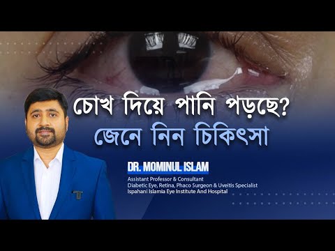 How to Get Rid of Watery Eye! চোখ দিয়ে পানি পড়লে কী করবেন?Dr Mominul Islam