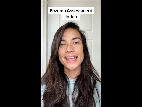 Eczema Assessment Update