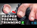 Stop Toenail Trimming Mistakes Podiatrist Tips