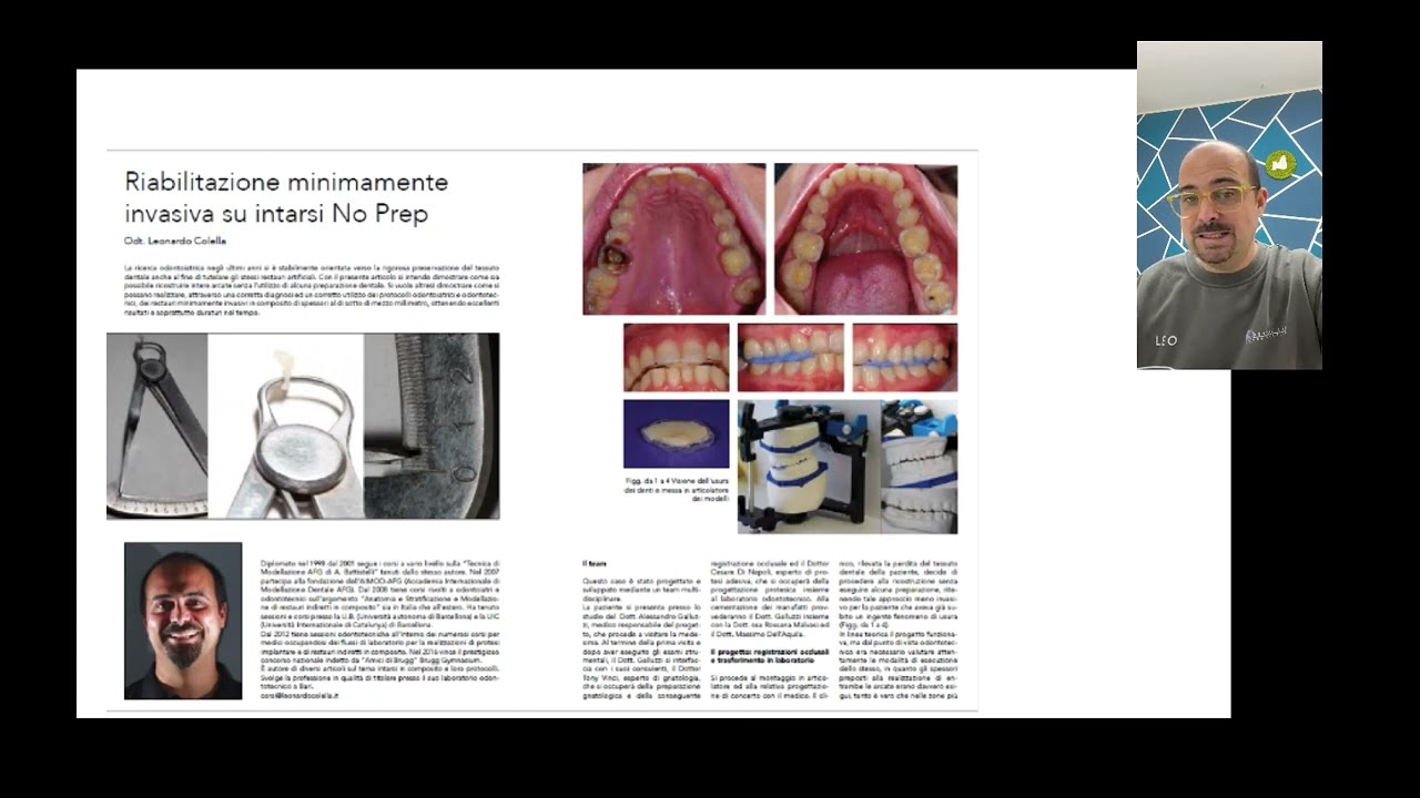 Intarsio in composito, disilicato, fresati o stratificati