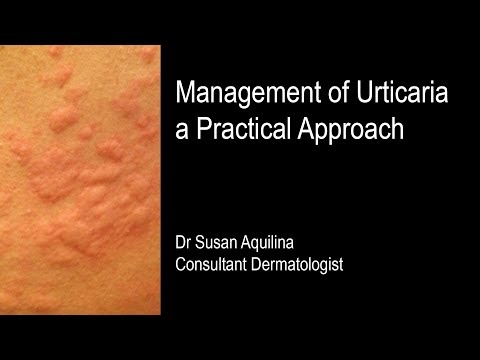 férgek és urticaria