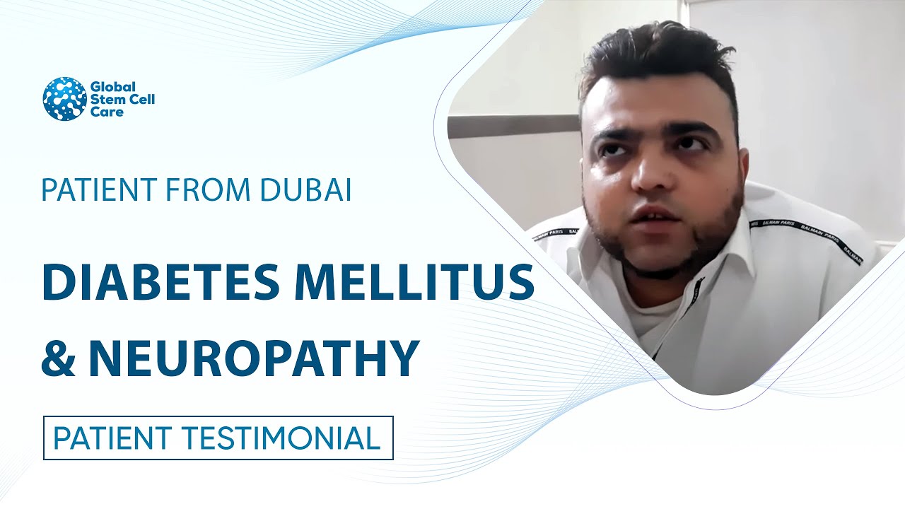 Stem Cell Therapy For Diabetes Mellitus and Neuropathy | Best Treatment For Diabetes | Neuropathy