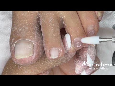 PEDICURA  paso a paso | TRANSFORMACIÓN DE UÑAS 💅 🦶😍