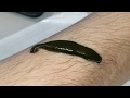 Leech TimeLapse Feeding