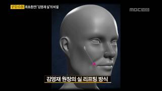 [글로비성형외과] PD수첩 노봉일원장님 영상